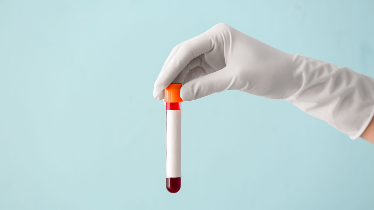 Blood Test