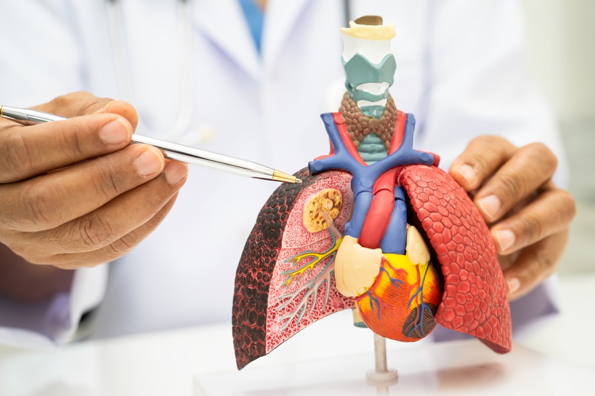 Lung Cancer