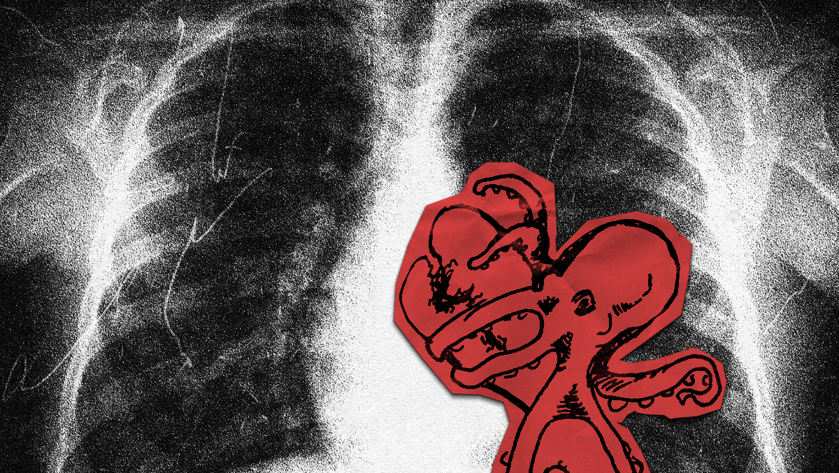BrokenHeart(600x338)